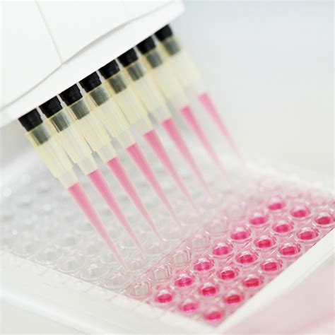 cytokine multiplex elisa kit